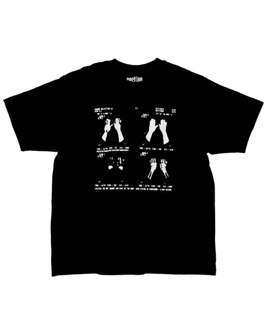 X-Ray Tee (Black)